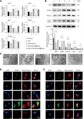 Robust intervention for oxidative stress-induced injury in periodontitis via controllably released nanoparticles that regulate the ROS-PINK1-Parkin pathway